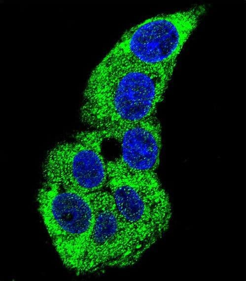 IHC-plus™ ACTG1 / Gamma Actin Antibody (aa188-215)