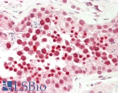 CREM / ICER Antibody (Internal)