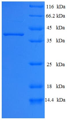 Human PLEKHB2 Protein (Recombinant His-SUMO)