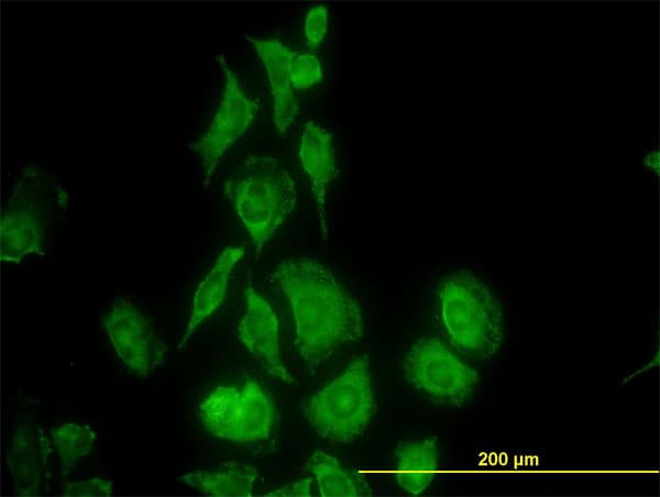 TIMP2 Antibody (clone 5D7)