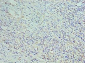 Polyclonal Rabbit anti-Human CD74 / CLIP Antibody (aa137-296, IHC)
