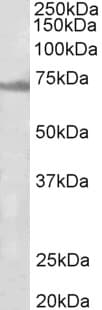 IHC-plus™ Polyclonal Goat anti-Human ENC1 Antibody (aa452-464, IHC, WB)