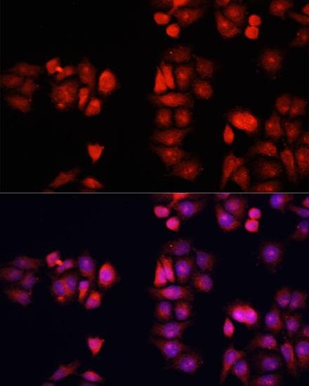 BMP1 Antibody