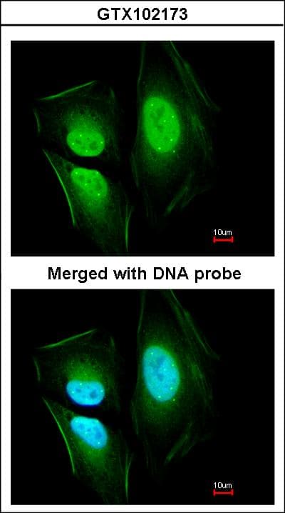Polyclonal Rabbit anti-Human EFCAB14 Antibody (aa243-495, IHC, WB)