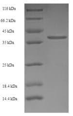 Human TMEM141 Protein (Recombinant GST, N-terminus)