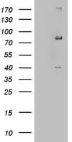 EHHADH / Enoyl-Coa Hydratase Antibody (aa496-723, clone OTI2C4, Carrier-free)