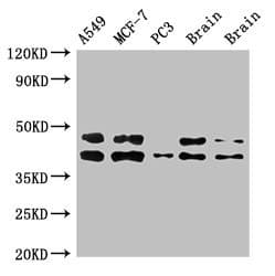 Polyclonal Rabbit anti-Human PRKACB Antibody (IHC, IF, WB)