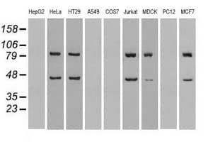 SSB / La Antibody (clone OTI3H9)