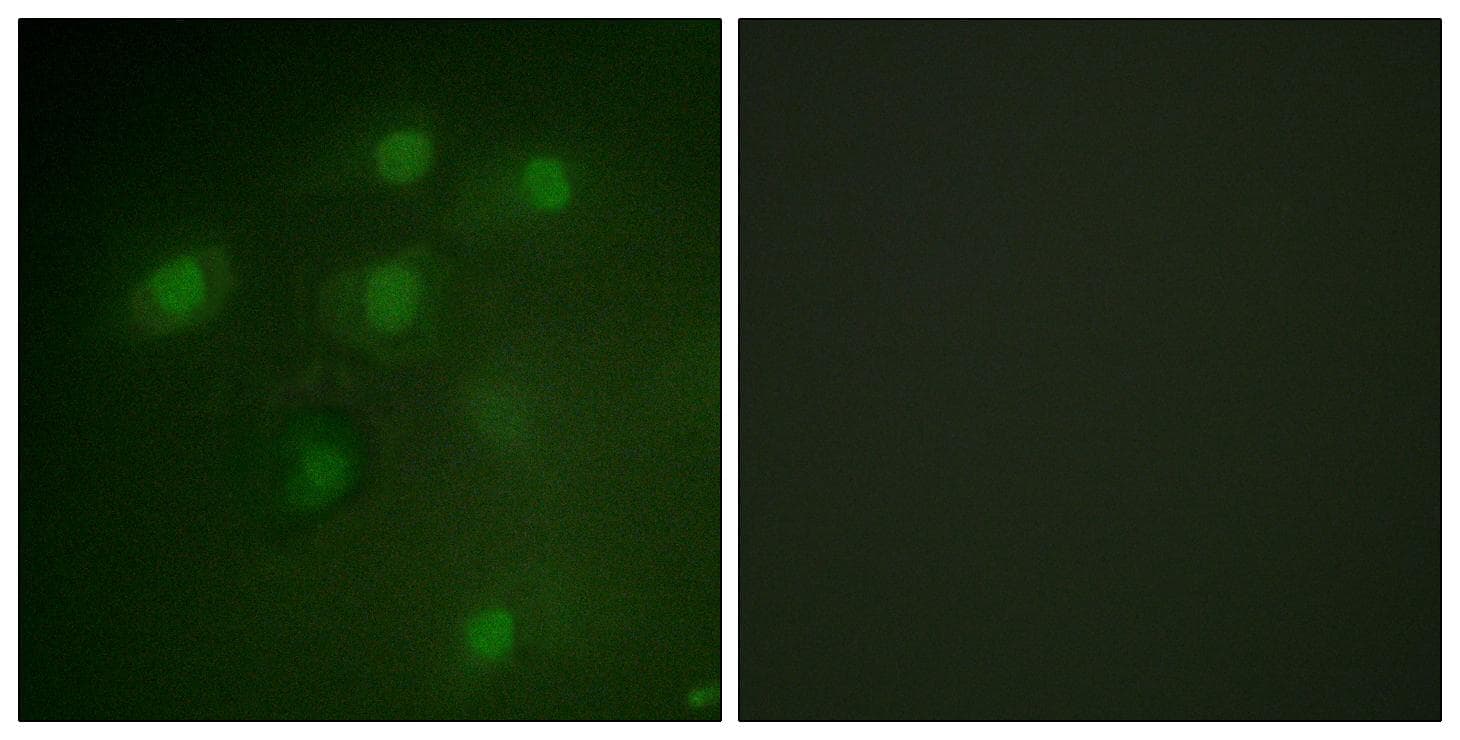 PDCD4 Antibody (p457)