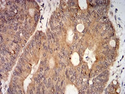 CPV-NS1 Antibody (clone 2B5B7)