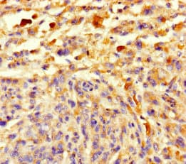 CCDC184 Antibody