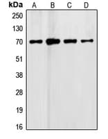 FST / Follistatin Antibody (Internal)