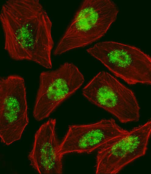 RFX / RFX1 Antibody (aa896-925)