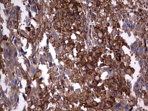 KRT7 / CK7 / Cytokeratin 7 Antibody (clone OTI2A2)