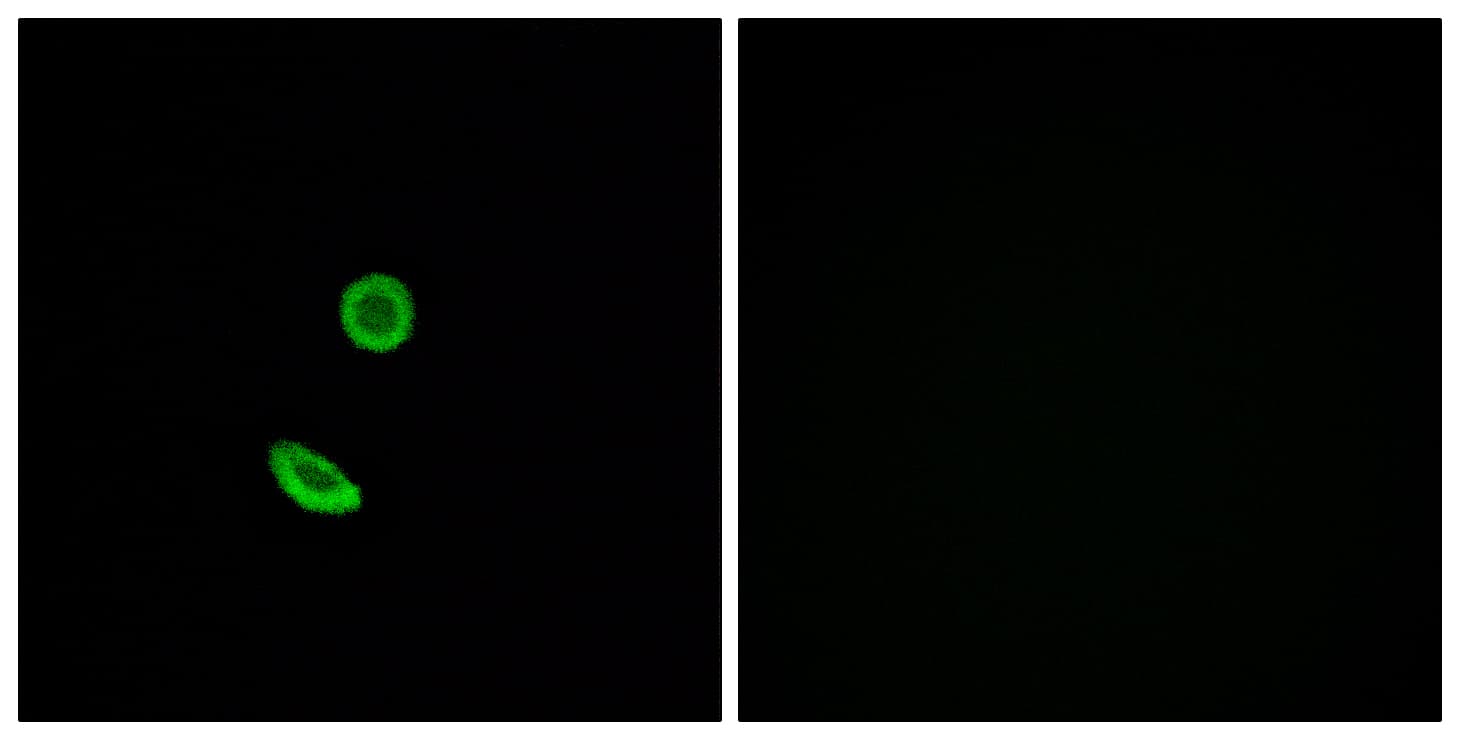 OR8H2 Antibody (aa87-136)