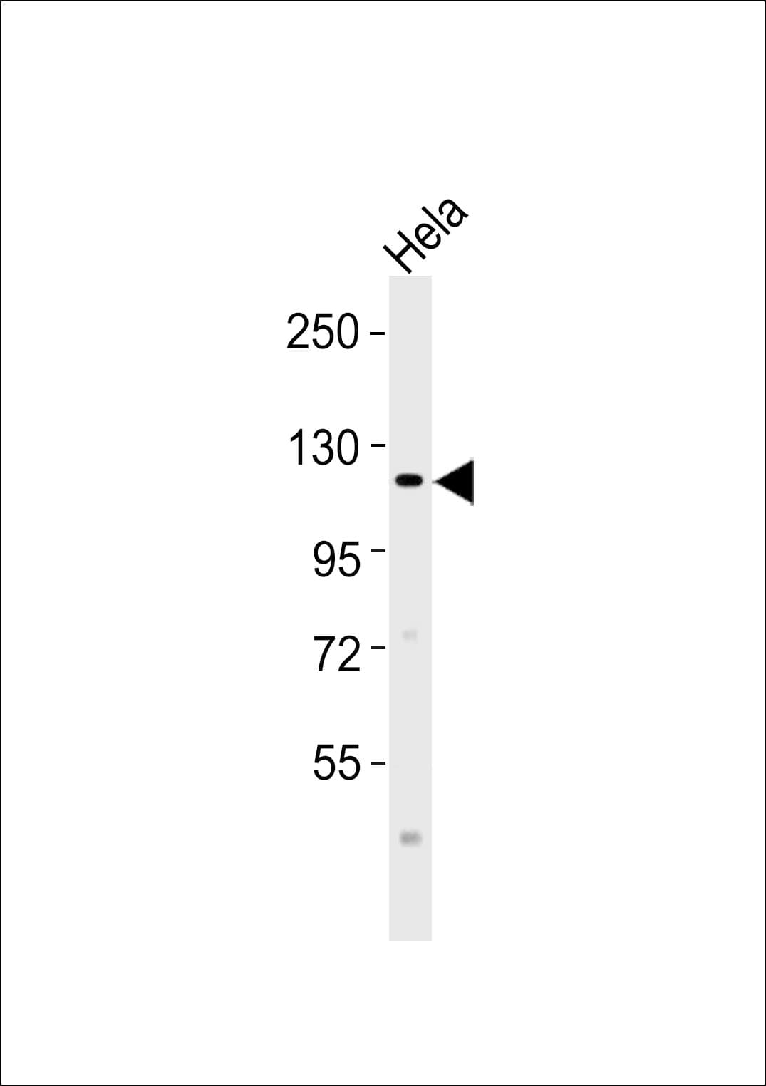 DRPLA / Atrophin-1 Antibody