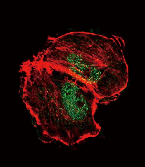 Polyclonal Rabbit anti-Human Tuberin / TSC2 Antibody (phospho-Ser664, IF)