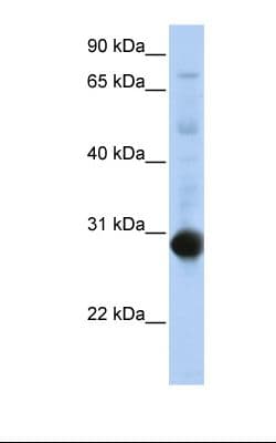 Polyclonal Rabbit anti-Human NR0B2 Antibody (aa110-159, IHC, WB)