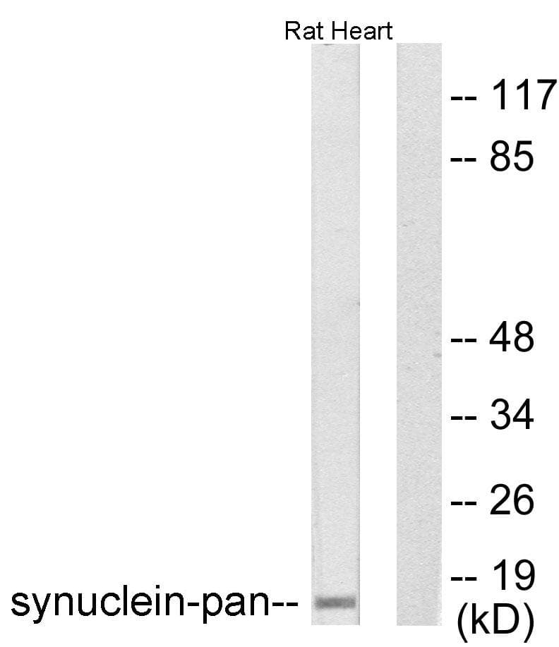 Polyclonal Rabbit anti-Human SNCA / Alpha-Synuclein Antibody (IHC, WB)