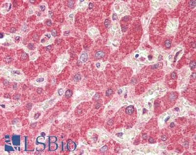 IHC-plus™ Polyclonal Rabbit anti-Human GLS2 / Glutaminase 2 Antibody (IHC)