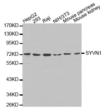 IHC-plus™ SYVN1 / HRD1 Antibody