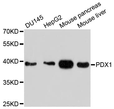 Polyclonal Rabbit anti-Human PDX1 Antibody (WB)