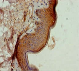 AK6 / Adenylate Kinase 6 Antibody