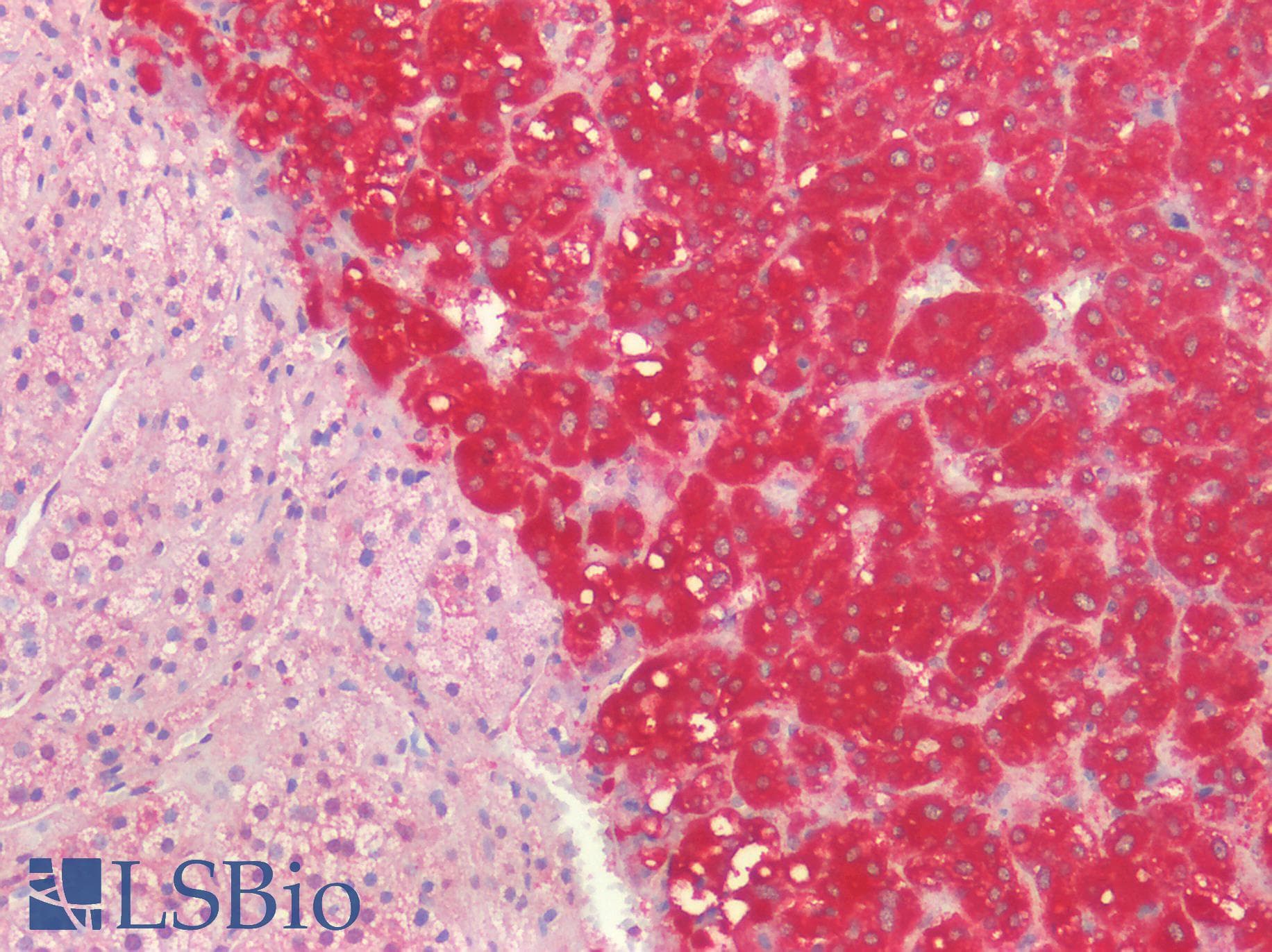 IHC-plus™ SLC27A1 / FATP Antibody