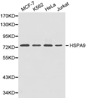 Polyclonal Rabbit anti-Human HSPA9 / Mortalin / GRP75 Antibody (IHC, WB)