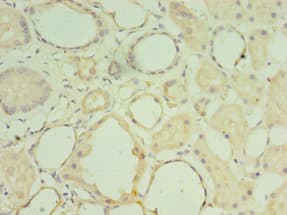 MATN3 / Matrilin 3 Antibody (aa277-486)