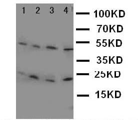 LCN1 / Lipocalin-1 Antibody (aa110-124)