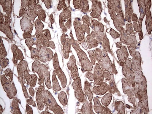 Monoclonal Mouse anti-Human Adiponectin Antibody (clone 3D11, Carrier-free, aa19-244, IHC, WB)