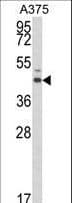 ESRRA / ERR Alpha Antibody (aa131-159)