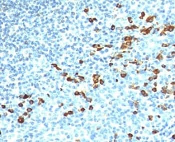 Mouse Anti-Human IgM Secondary Antibody (clone ICO-30)