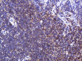 Monoclonal Mouse anti-Human SPN / CD43 Antibody (clone OTI6A4, IHC, WB)