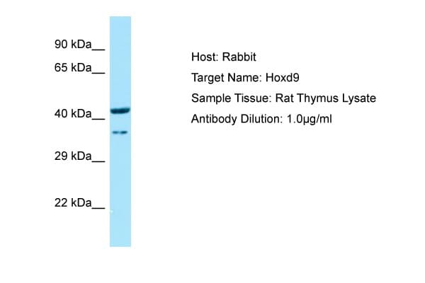 HOXD9 Antibody (N-Terminus)