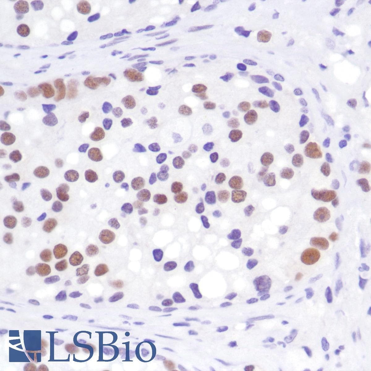 AR / Androgen Receptor Antibody (C-Terminus, clone SP242)