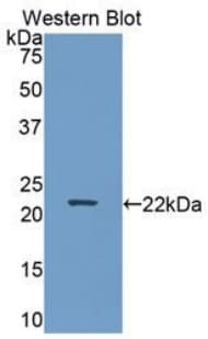 APOB / Apolipoprotein B Antibody (aa3365-3548)
