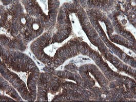 GORAB / SCYL1BP1 Antibody (aa35-394, clone OTI4F11, Carrier-free)