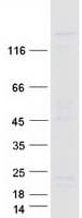 Human RGS3 Protein (Recombinant Myc-DDK (Flag))