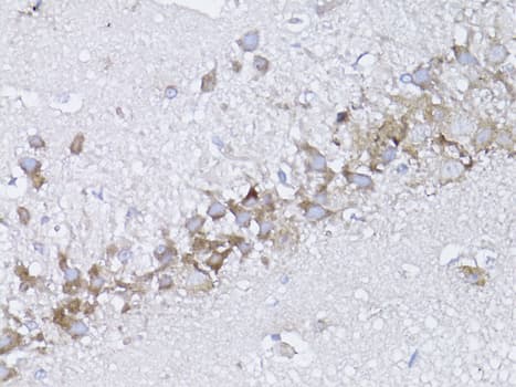 Polyclonal Rabbit anti-Human NGF Antibody (IHC, WB)