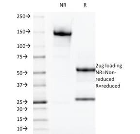 LGALS13 / Galectin 13 Antibody (clone PP13/1165)