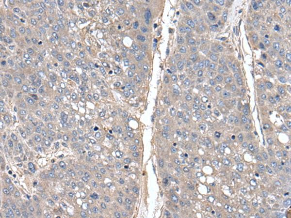 THAP10 Antibody