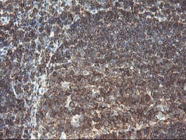 RFXANK Antibody (clone OTI3F5)