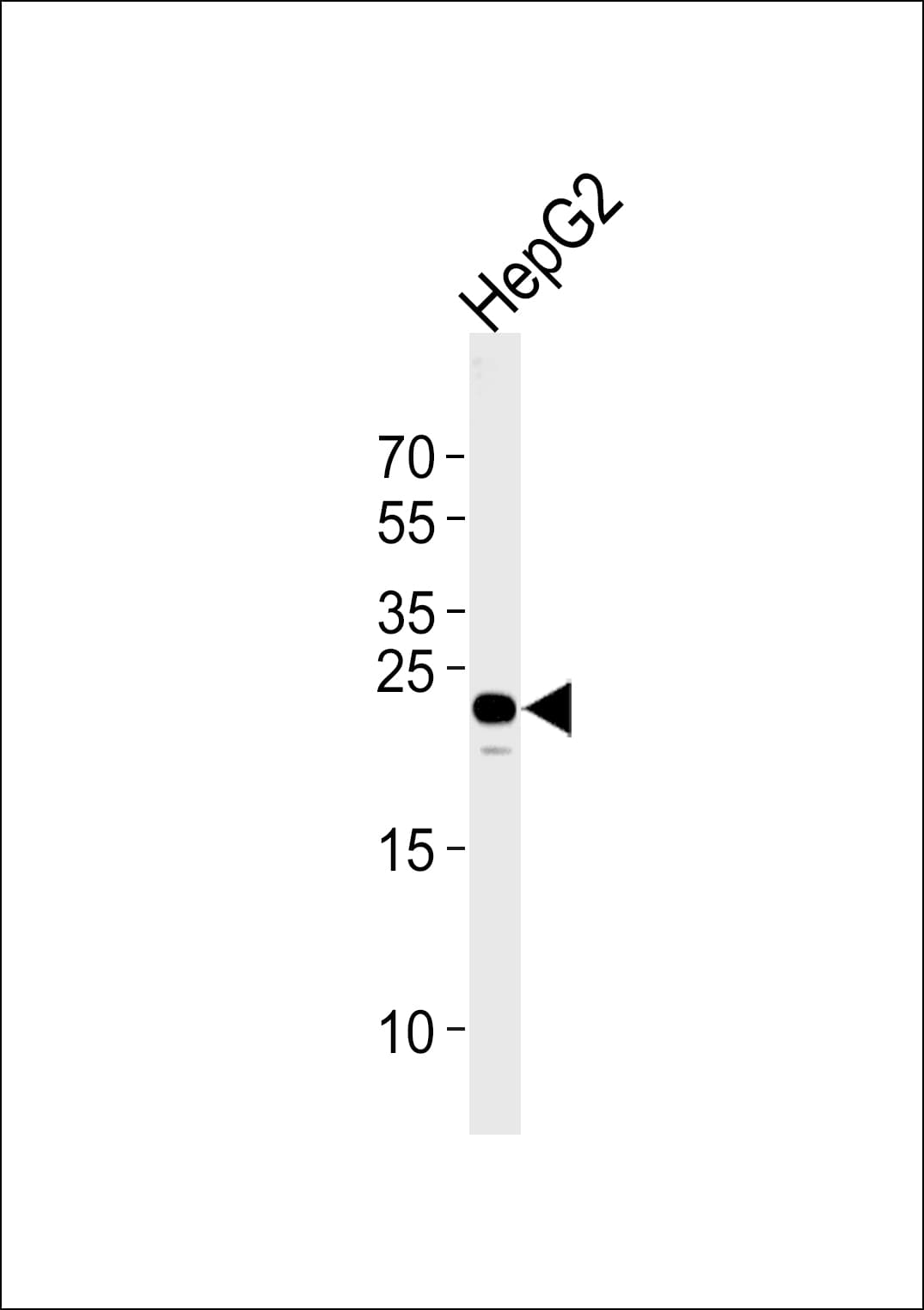 Polyclonal Rabbit anti-Human MMAB Antibody (aa50-81, WB)
