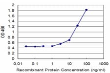 RPL14 / Ribosomal Protein L14 Antibody (clone 1B4)