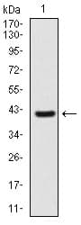 Monoclonal Mouse anti-Human SHH / Sonic Hedgehog Antibody (clone 5H4, IHC, WB)