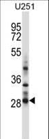 IHC-plus™ Polyclonal Rabbit anti-Human HOXC4 Antibody (aa197-225, IHC, WB)