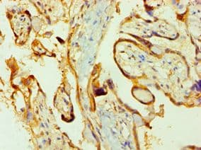 Polyclonal Rabbit anti-Human PPIB / Cyclophilin B Antibody (aa34-216, IHC, WB)