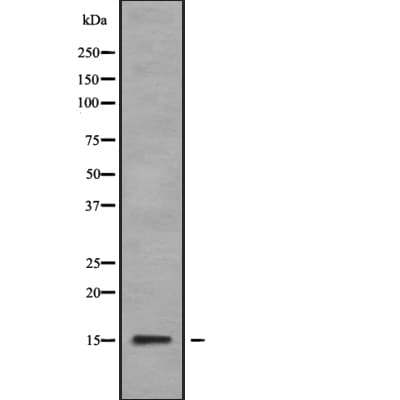 KIAA0087 Antibody